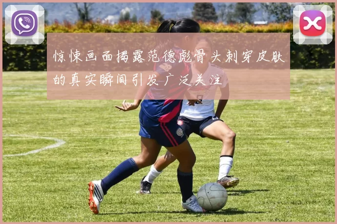 惊悚画面揭露范德彪骨头刺穿皮肤的真实瞬间引发广泛关注